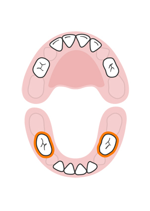 teeth-slideshow-teetheruption-6a.jpeg