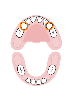 teeth-slideshow-teetheruption-7a.jpeg