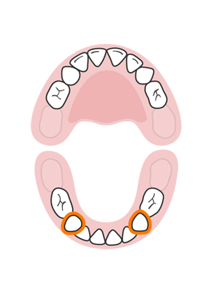 teeth-slideshow-teetheruption-8a.jpeg