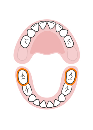 teeth-slideshow-teetheruption-9a.jpeg