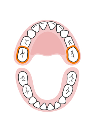 teeth-slideshow-teetheruption-10a.jpeg