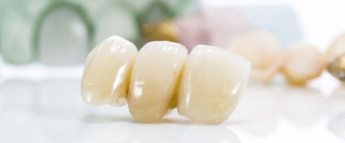 JSI Global |  - Prosthodontics