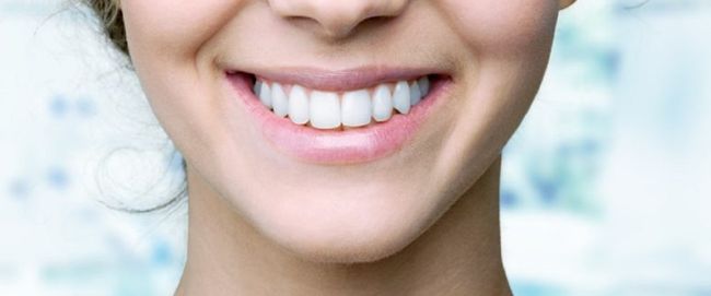 JSI Global |  - Teeth Whitening