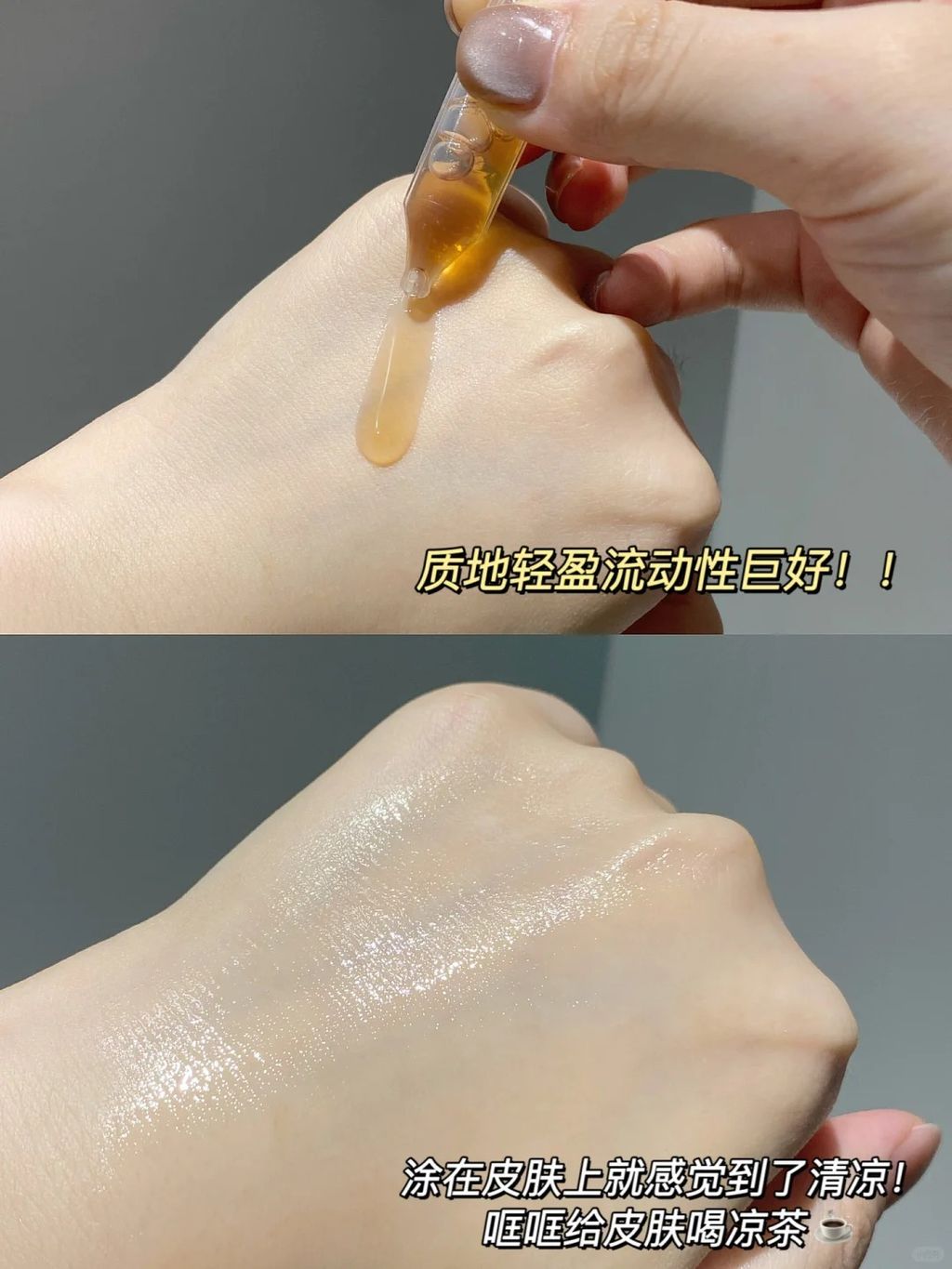 油痘敏肌绝鲨局‼️腿红祛痘速度好惊人！！_6_每天都是好心情鸭_来自小红书网页版