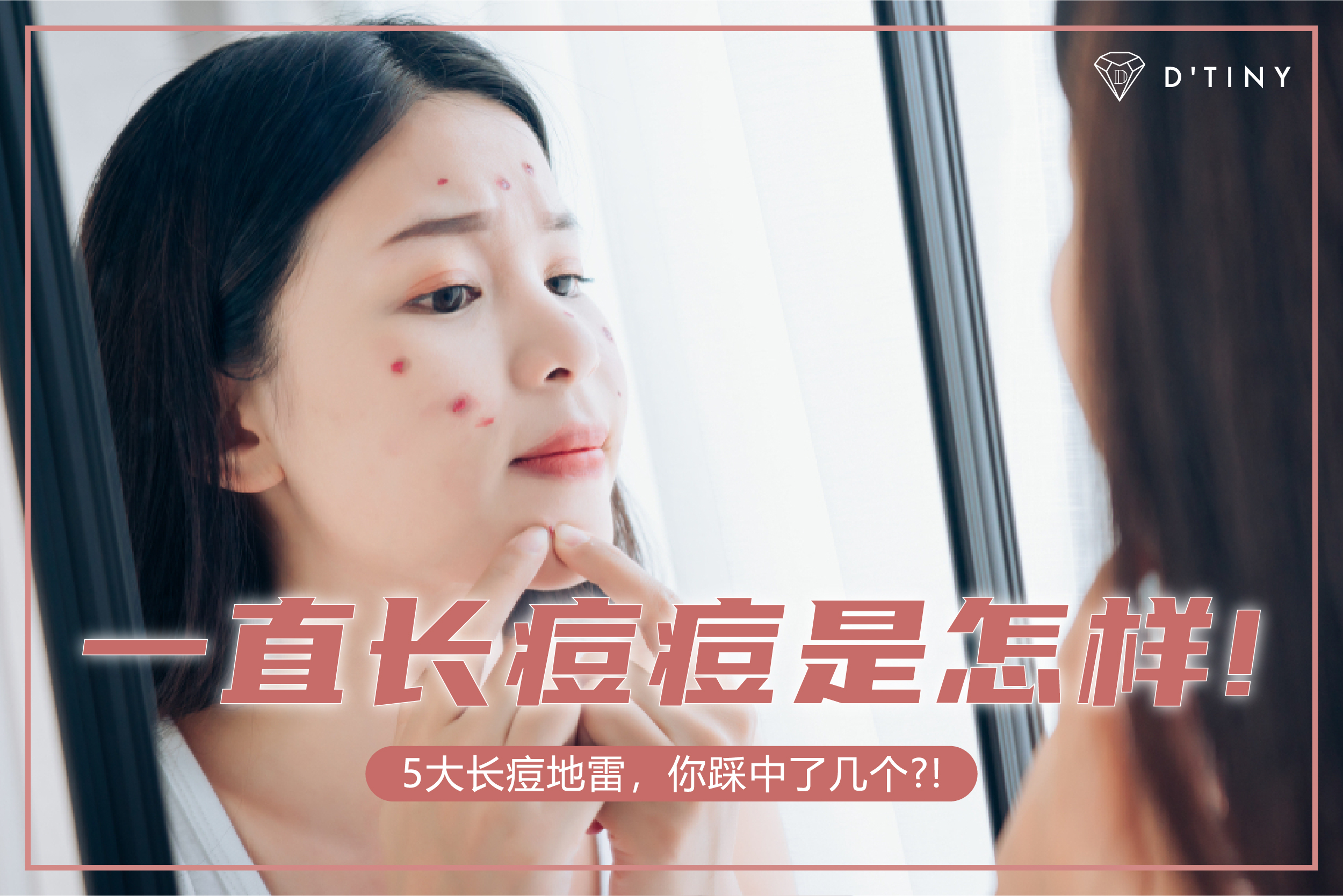 一直长痘痘是怎样! 5大长痘地雷,你踩中了几个?!