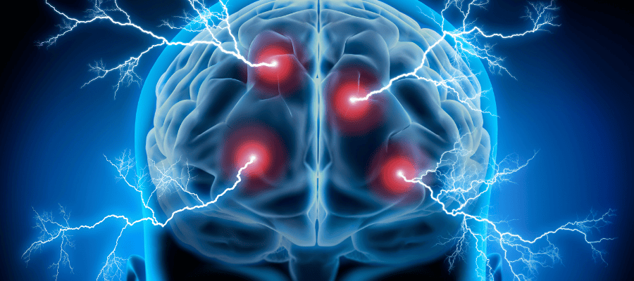 大腦神經-示意圖