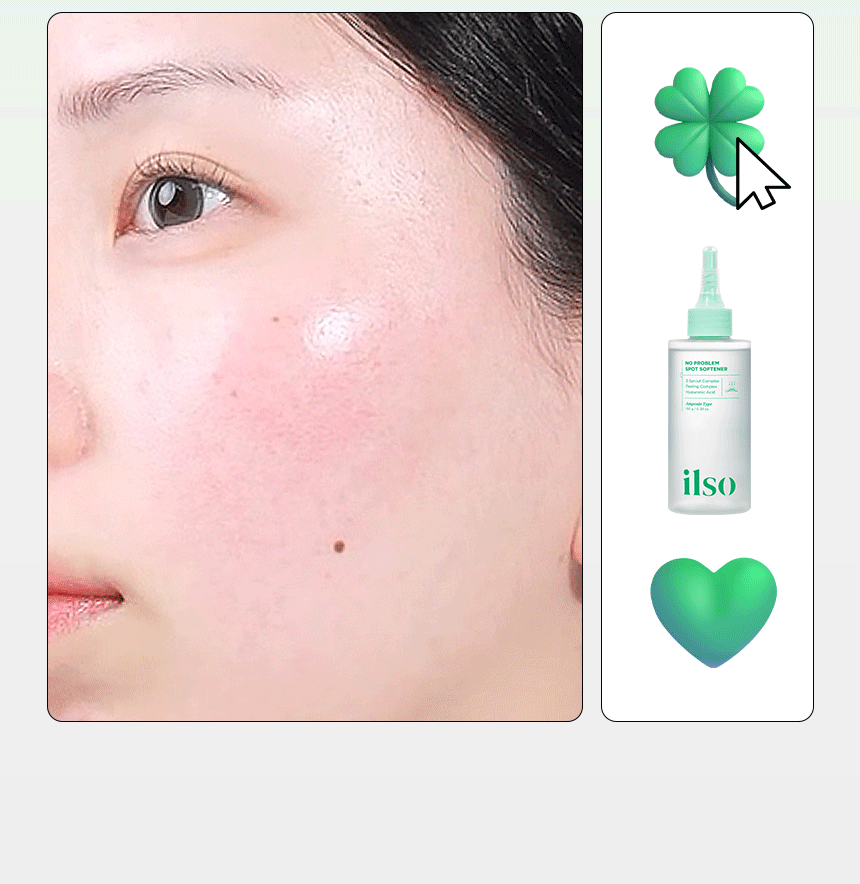 SPOT_SOFTENER_860_01_06