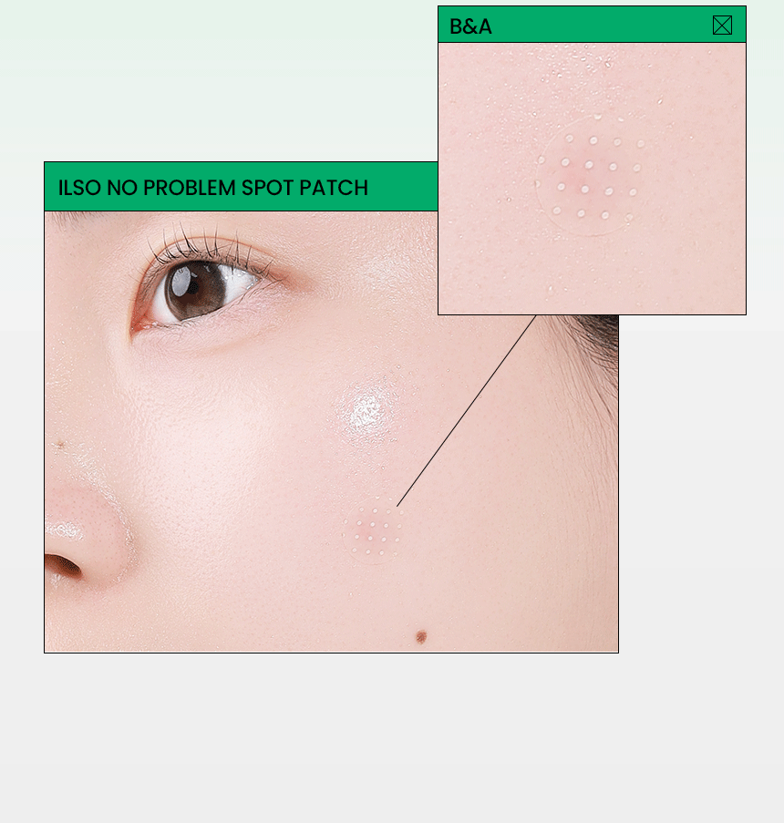 SPOT_PATCH_860_01_05