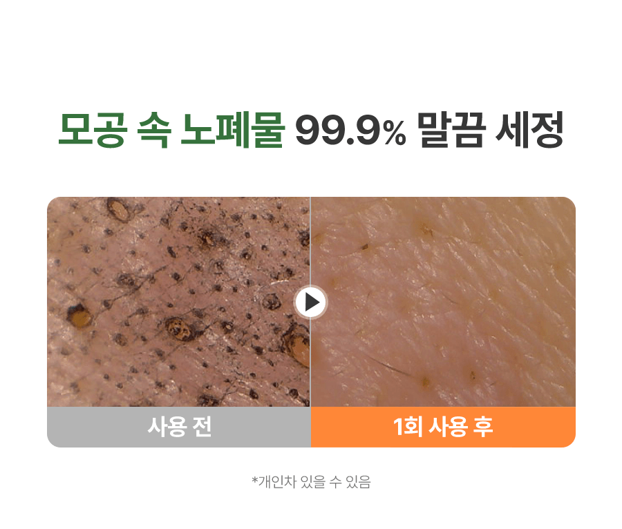 greenDeep_Pore_PacktoFoam_07