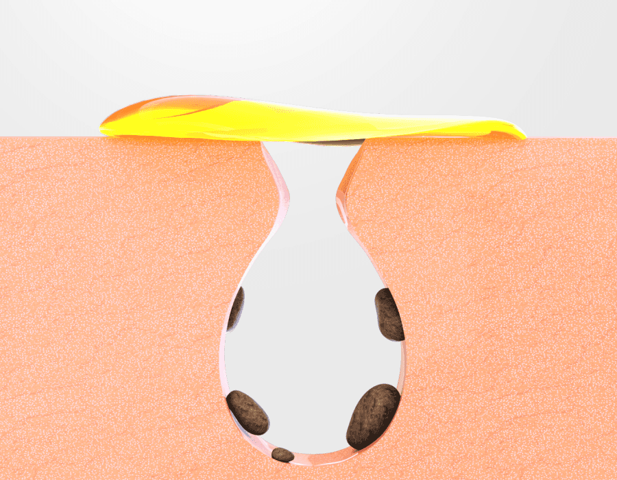 greenDeep_Pore_PacktoFoam_13