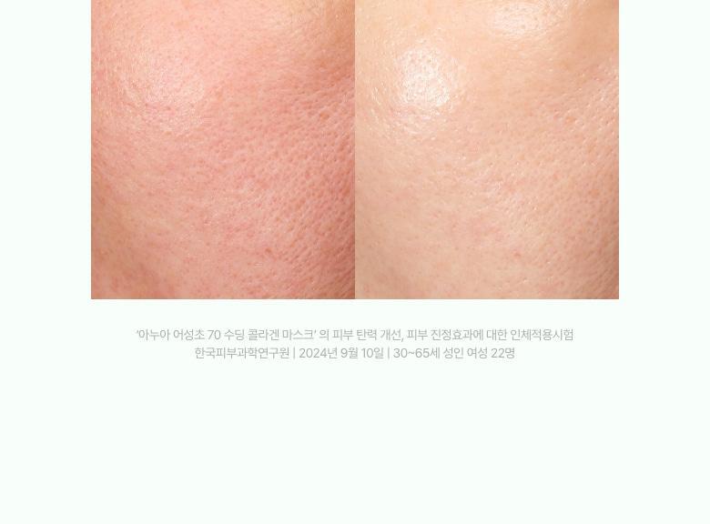 gelmask_heartleaf_8