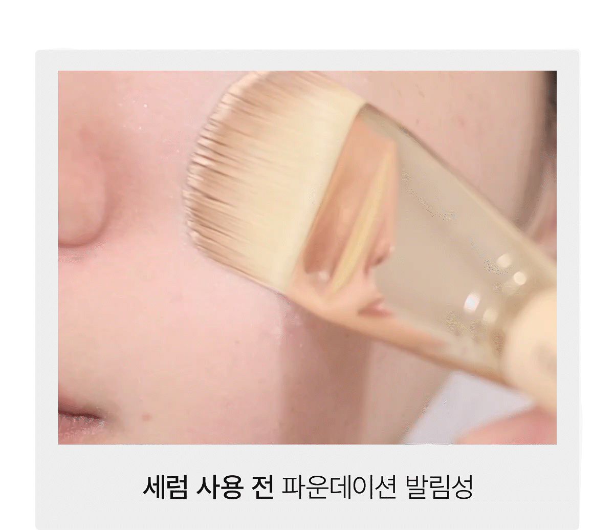 collagen_05