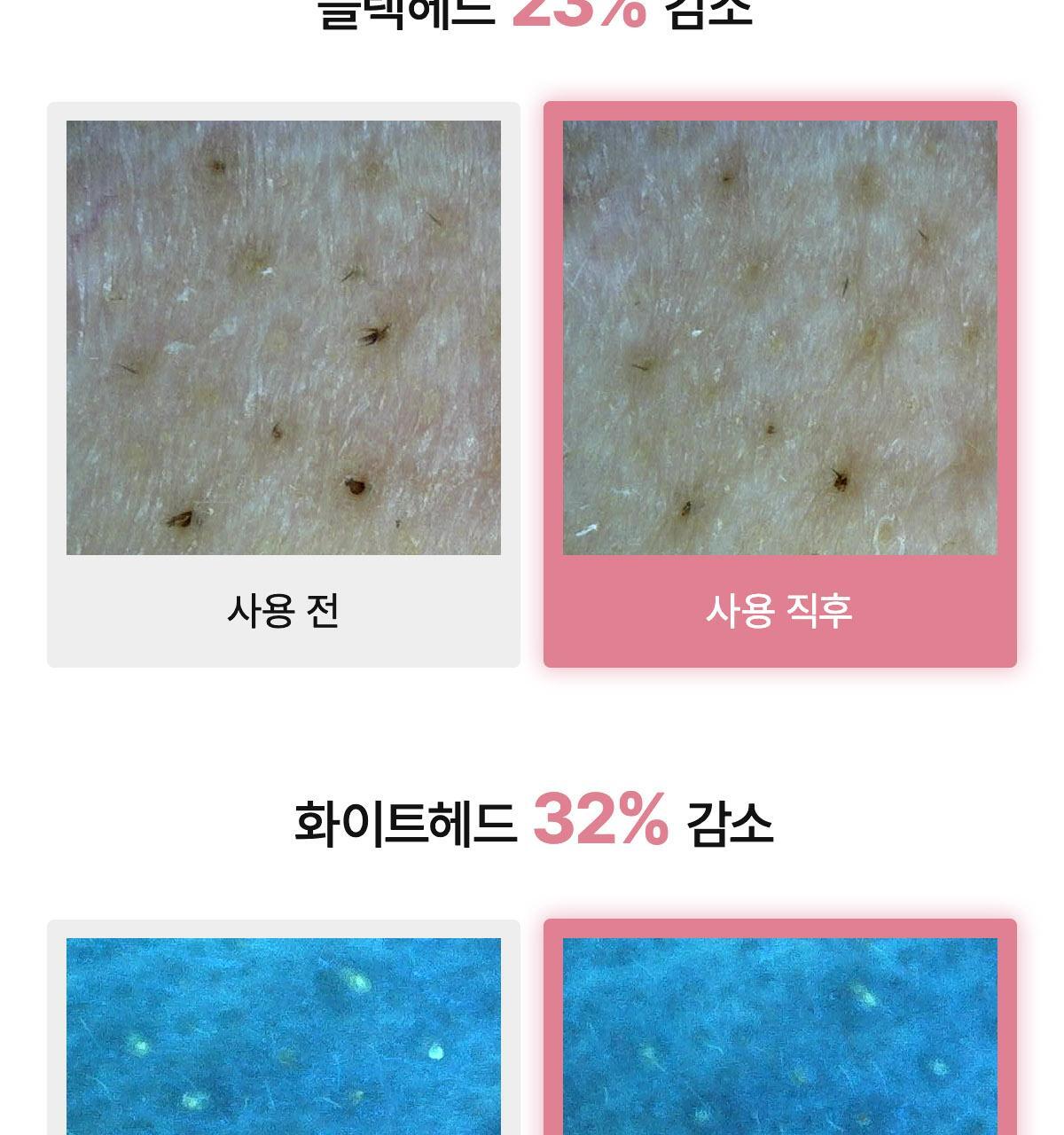 collagen_oil_B_03