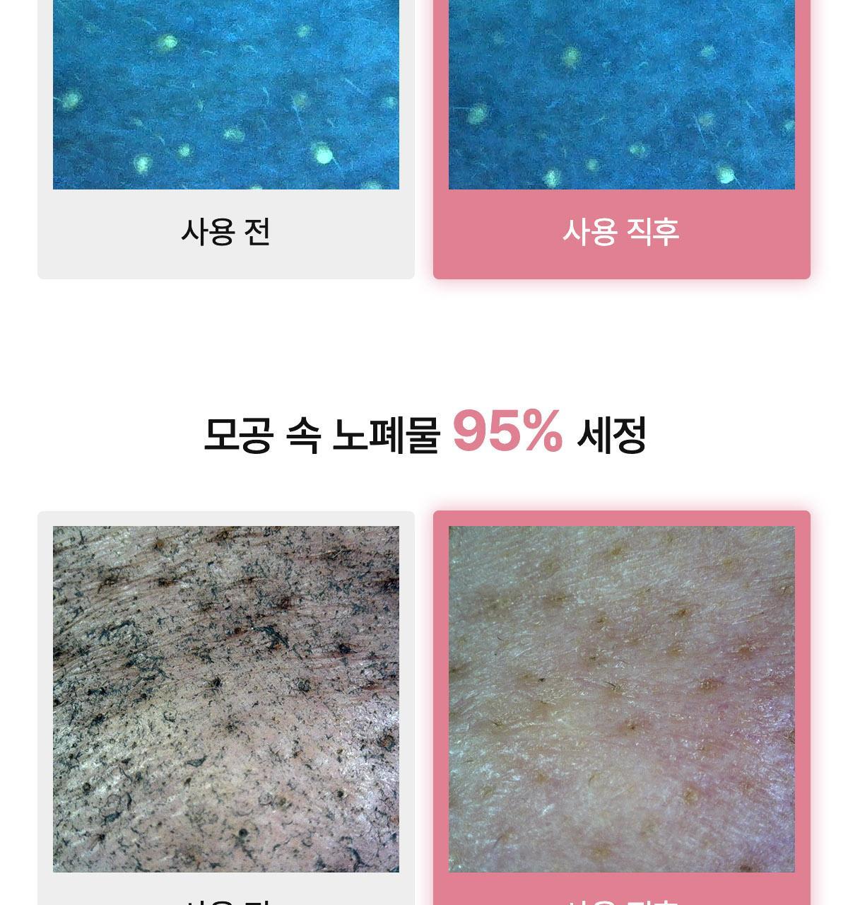 collagen_oil_B_03