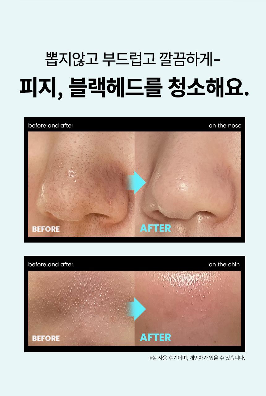 sebum_softener_key_13