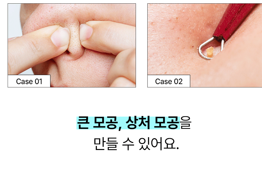 sebum_softener_key_10