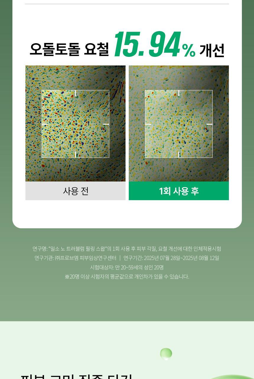 PEELING_SWAB_RE_OY_09(3)
