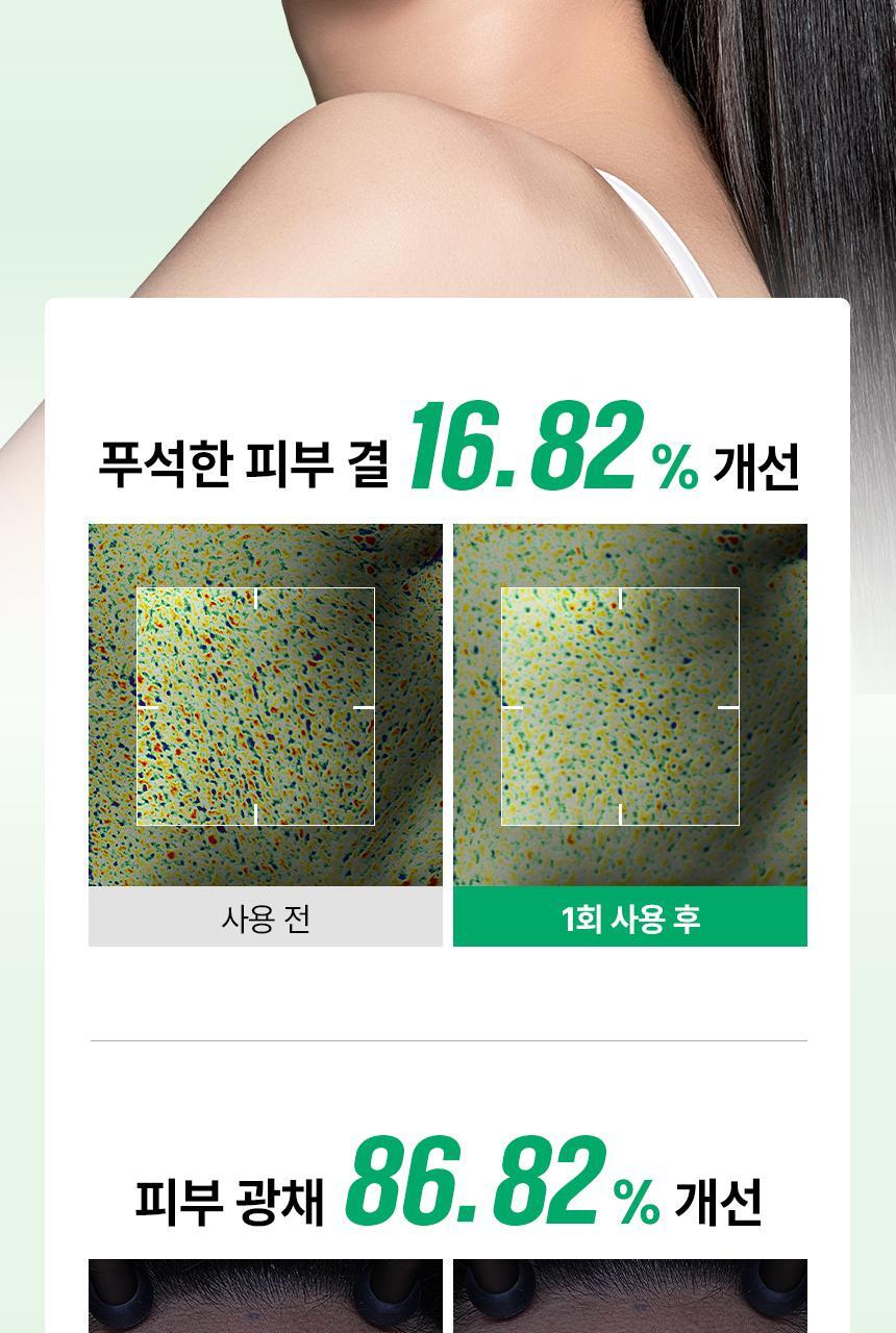 PEELING_SWAB_RE_OY_11(1)