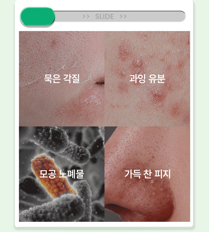 PEELING_SWAB_RE_OY_04