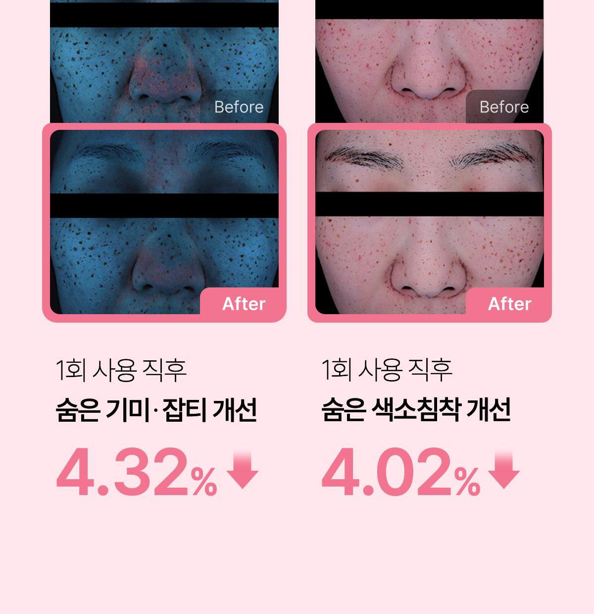 250112_ampoule_mask01_08(2)