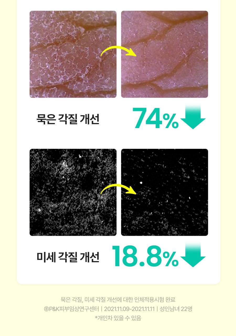 25_Brightening_PeelingGel_08(2)