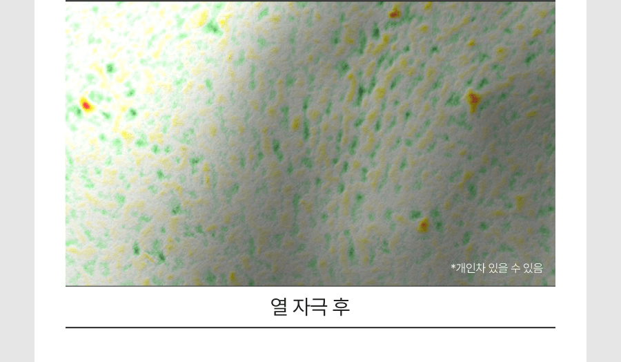 RedBlemish_CoolSoothingJellyMist_20