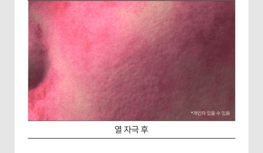 RedBlemish_CoolSoothingJellyMist_18