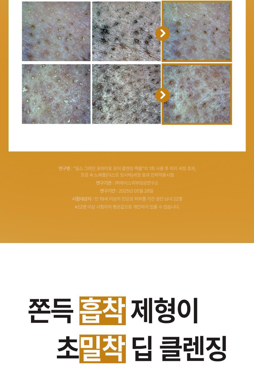 POTATO-PORE-CLEANSING-PACK-FOAM_band-02_03_(2)