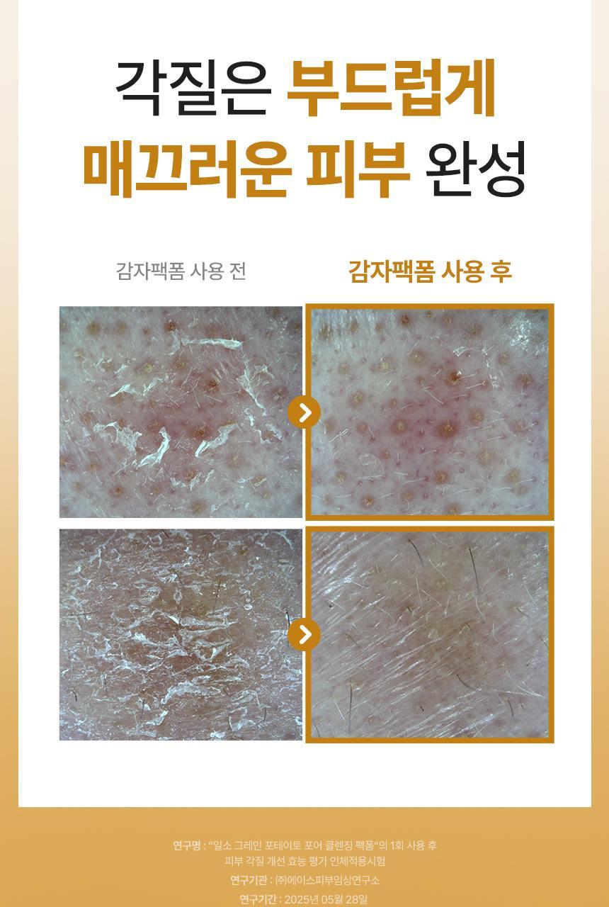 POTATO-PORE-CLEANSING-PACK-FOAM_band-02_07_