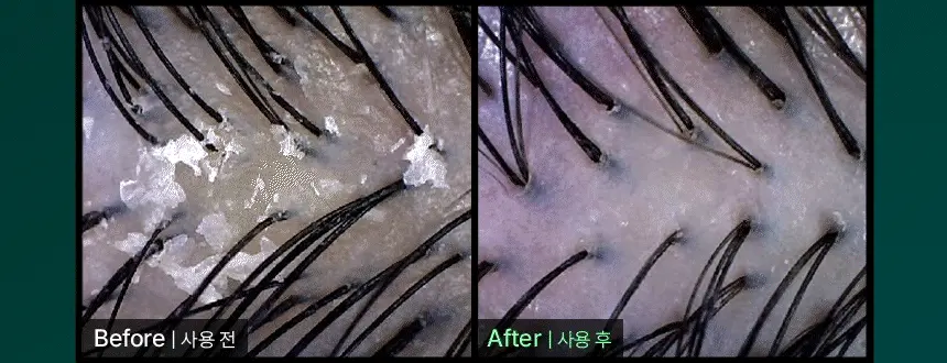 4_SHAMPOO500_31
