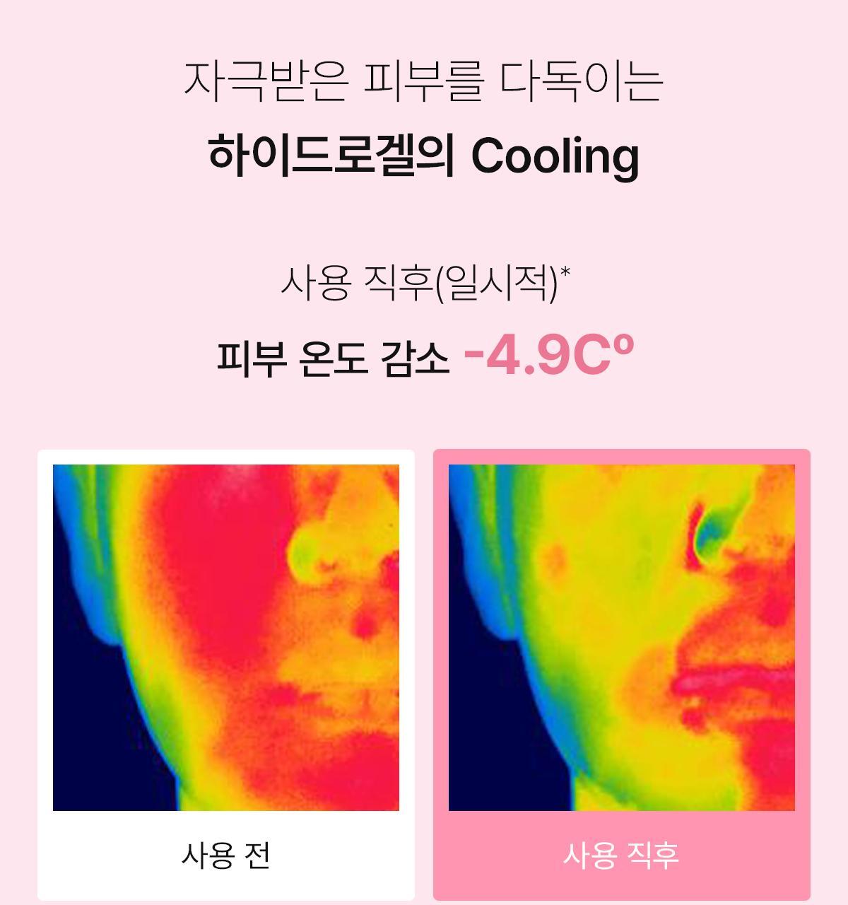 collagen_B_13(2)