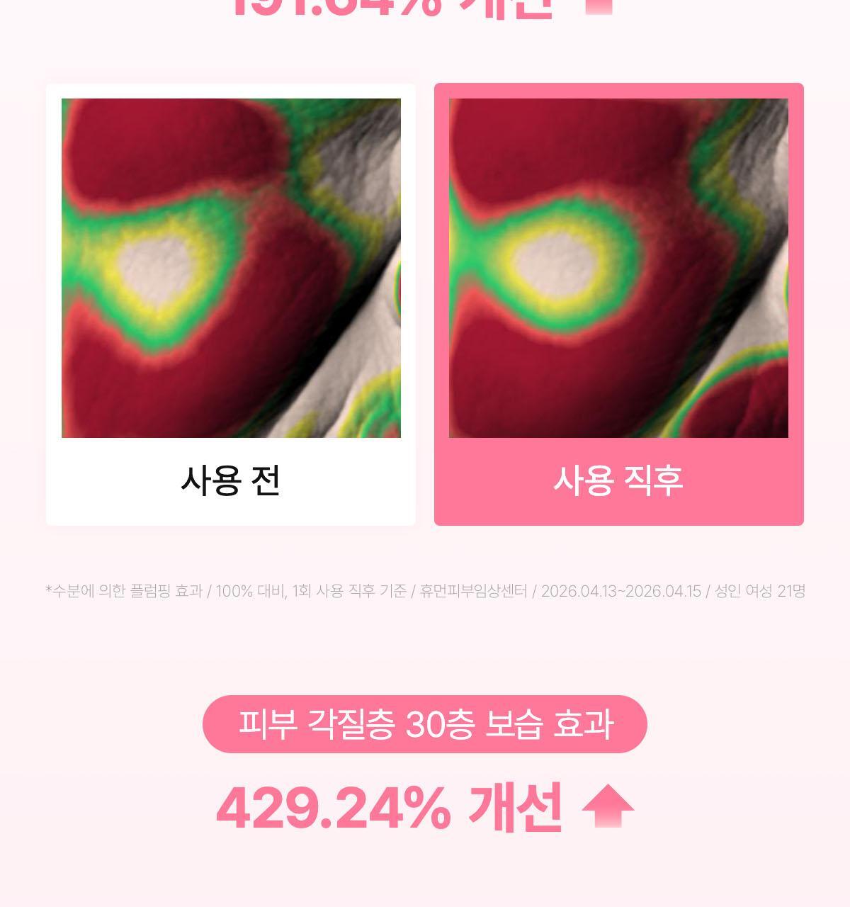 collagen_07(3)