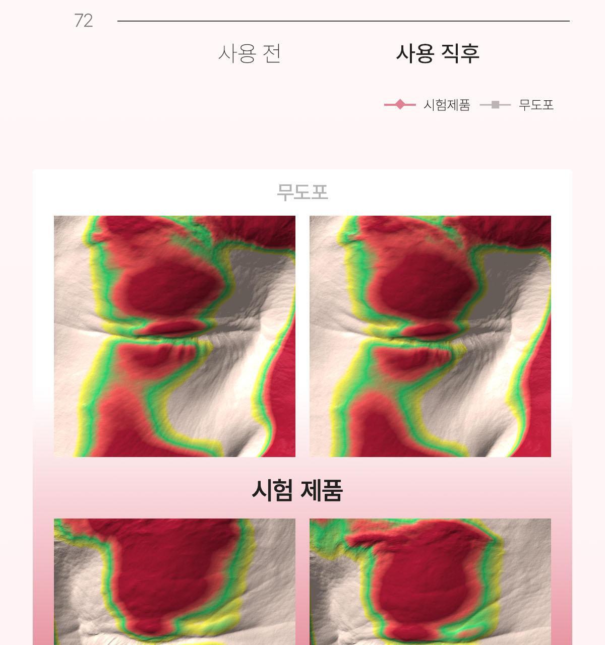 collagen_02(6)