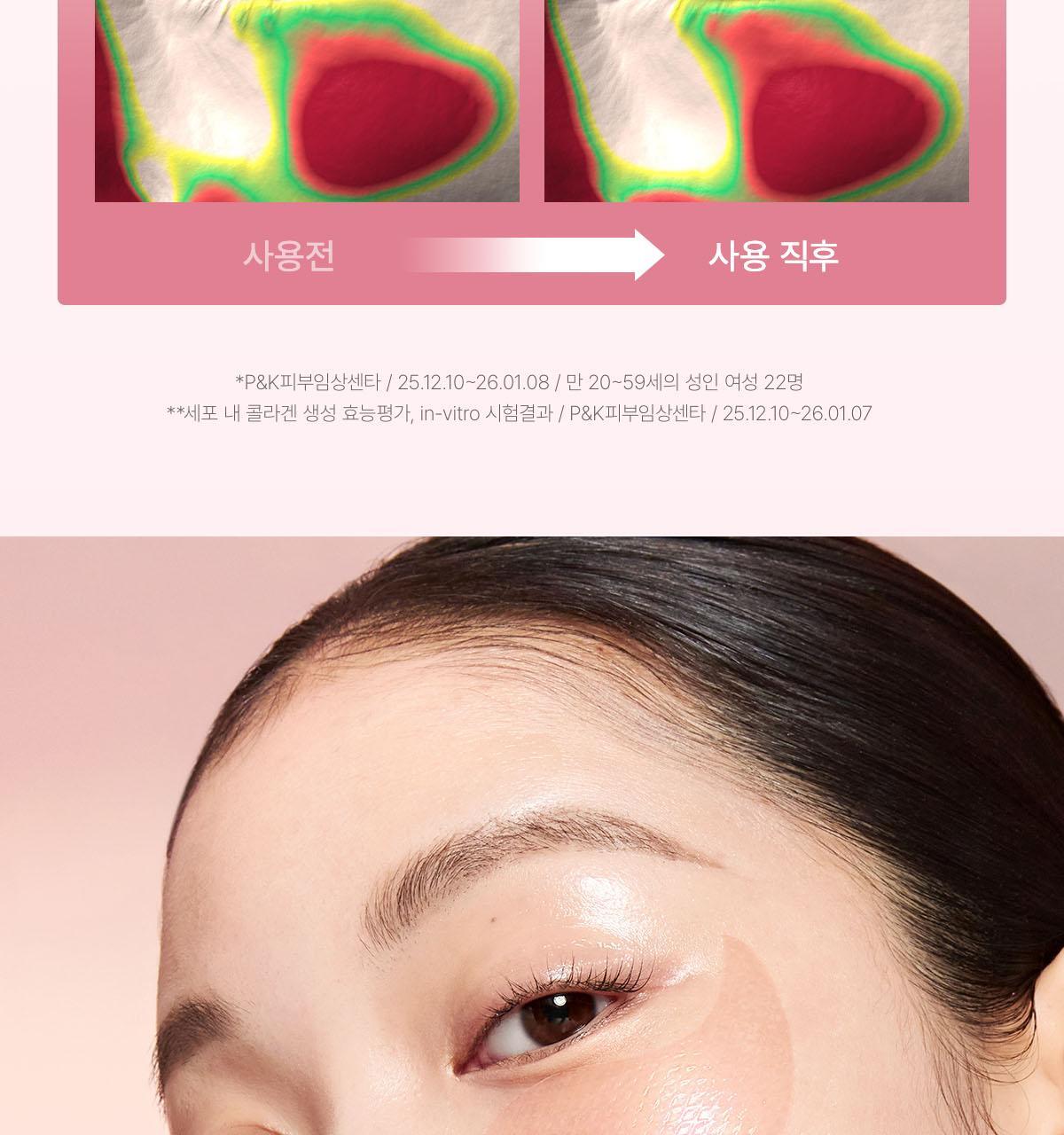 collagen_02(7)