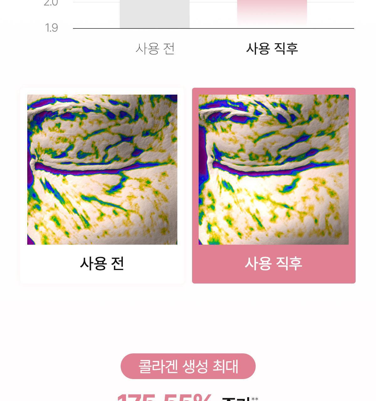collagen_02(3)