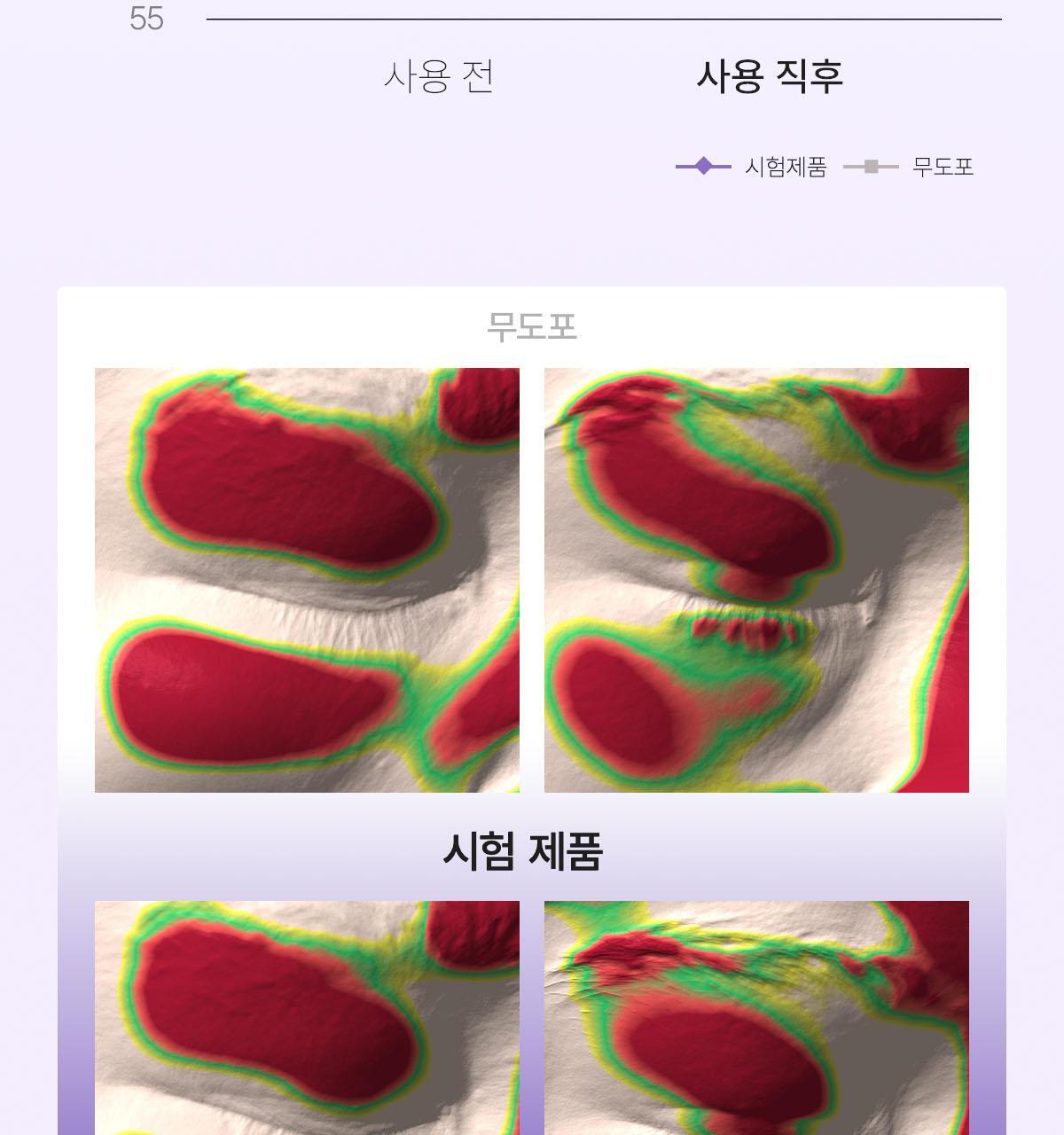 pdrn_02(6)