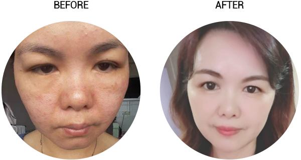 Cellglo-Creme21-Testimonial-Creme21-3.png Cellglo-Creme21-Testimonial-Creme21-3.png