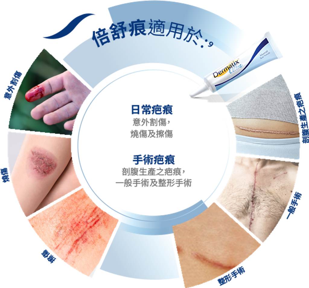 dermatix-ultra-effective-mobile-zh