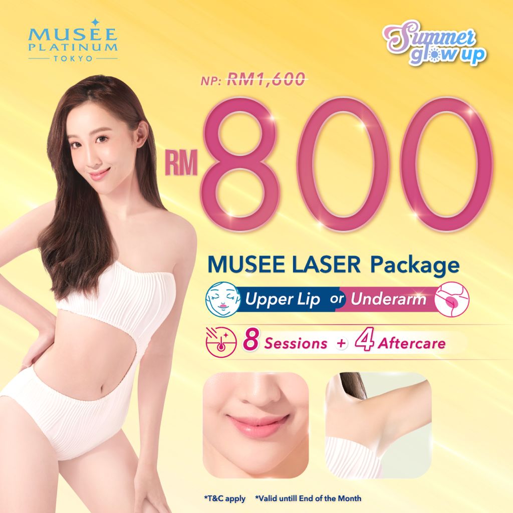 RM800 Musee Laser_01