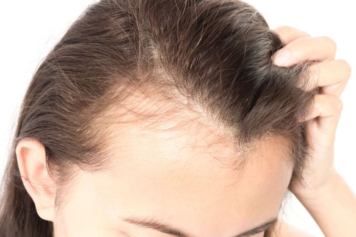 "Healthy Hair Start With Healthy Scalp"