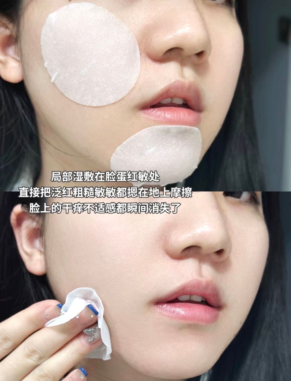 局部涅敷在检蛋红敹处