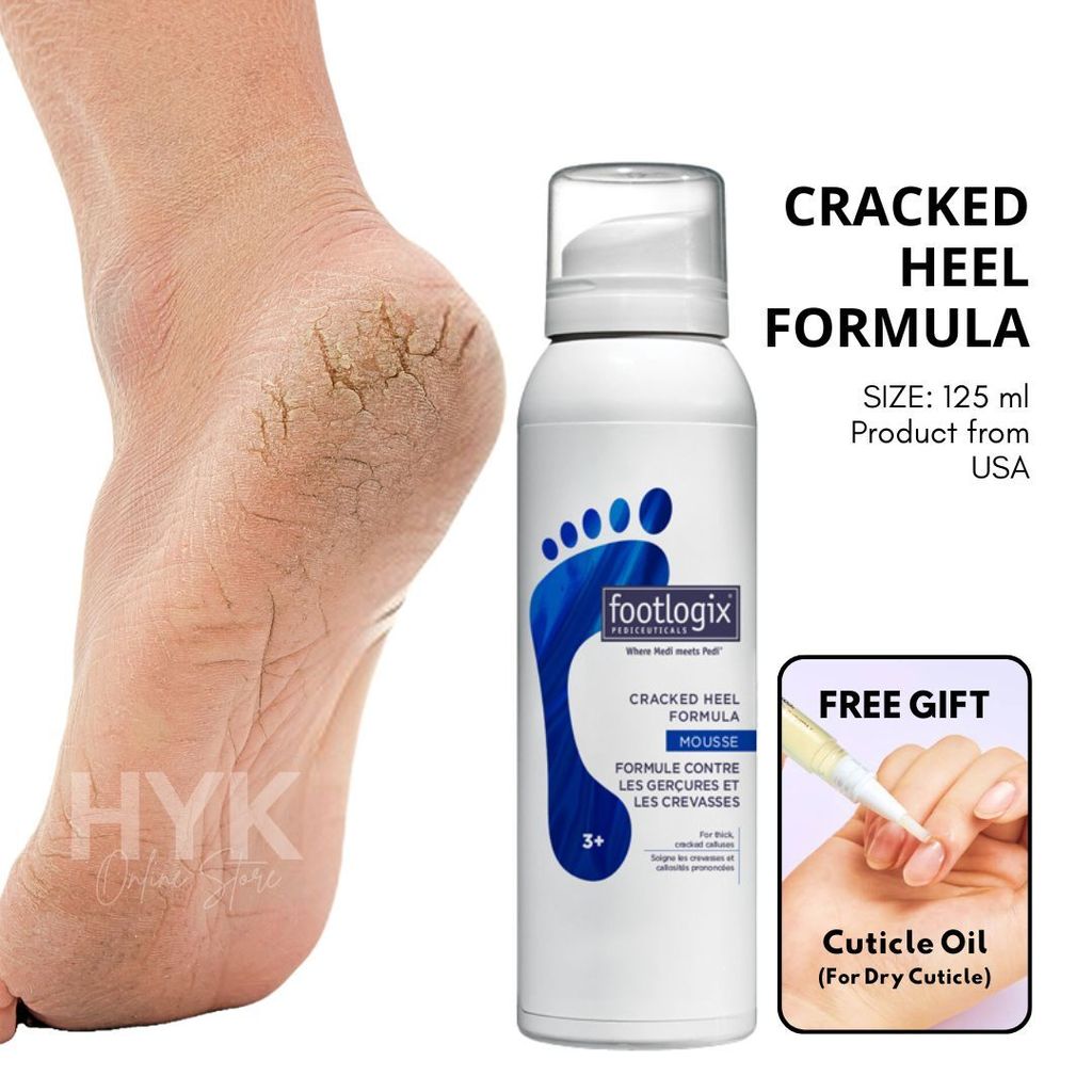3+ Cracked Heel