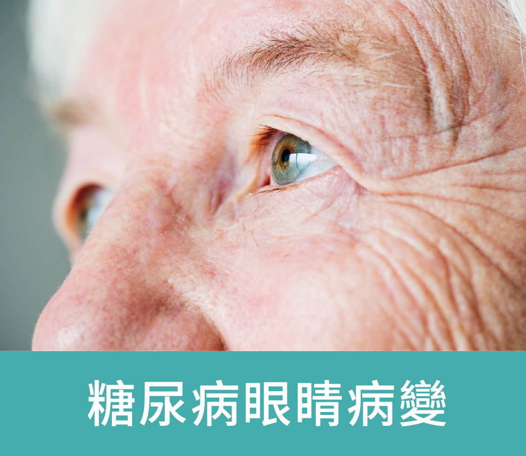 糖尿病眼睛病變_標題_工作區域 1