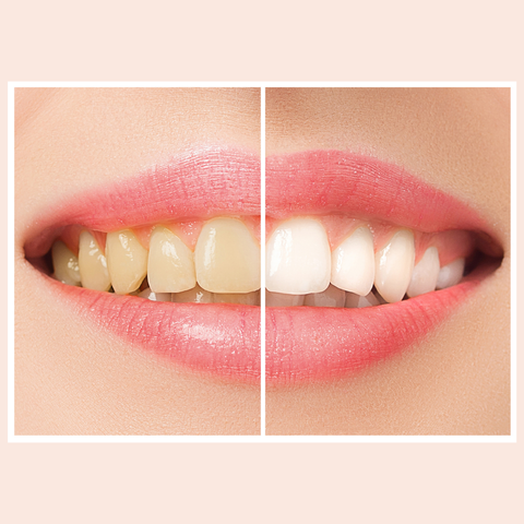 Untitled design-45.png