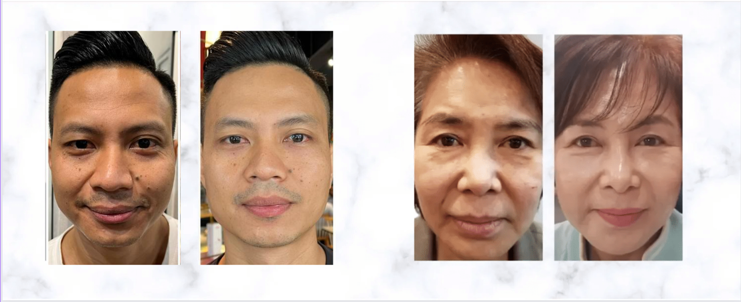 cellviaglobalnetwork - Reduce Wrinkles