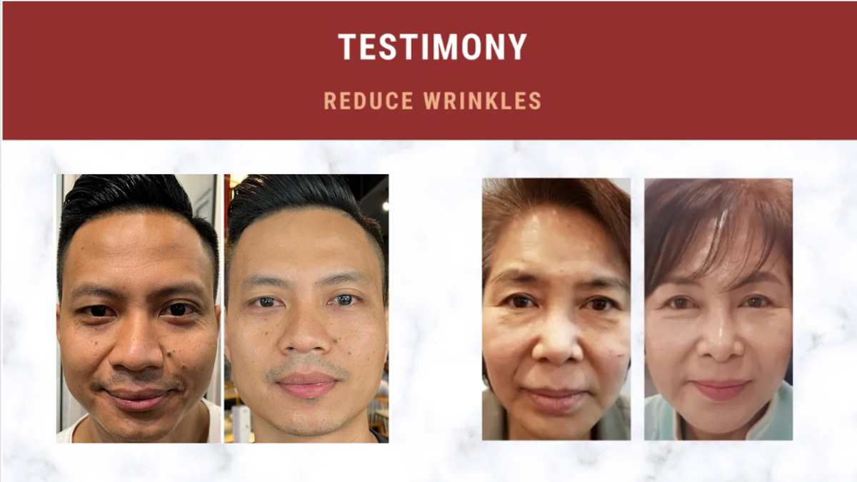 Helps to Reduce Wrinkles