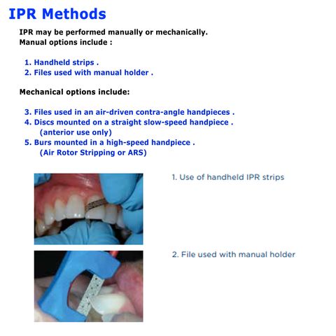 PRE-BOOK (ETA: 1 to 2 Wks) Orthodontic IPR Interproximal Enamel Kit ...