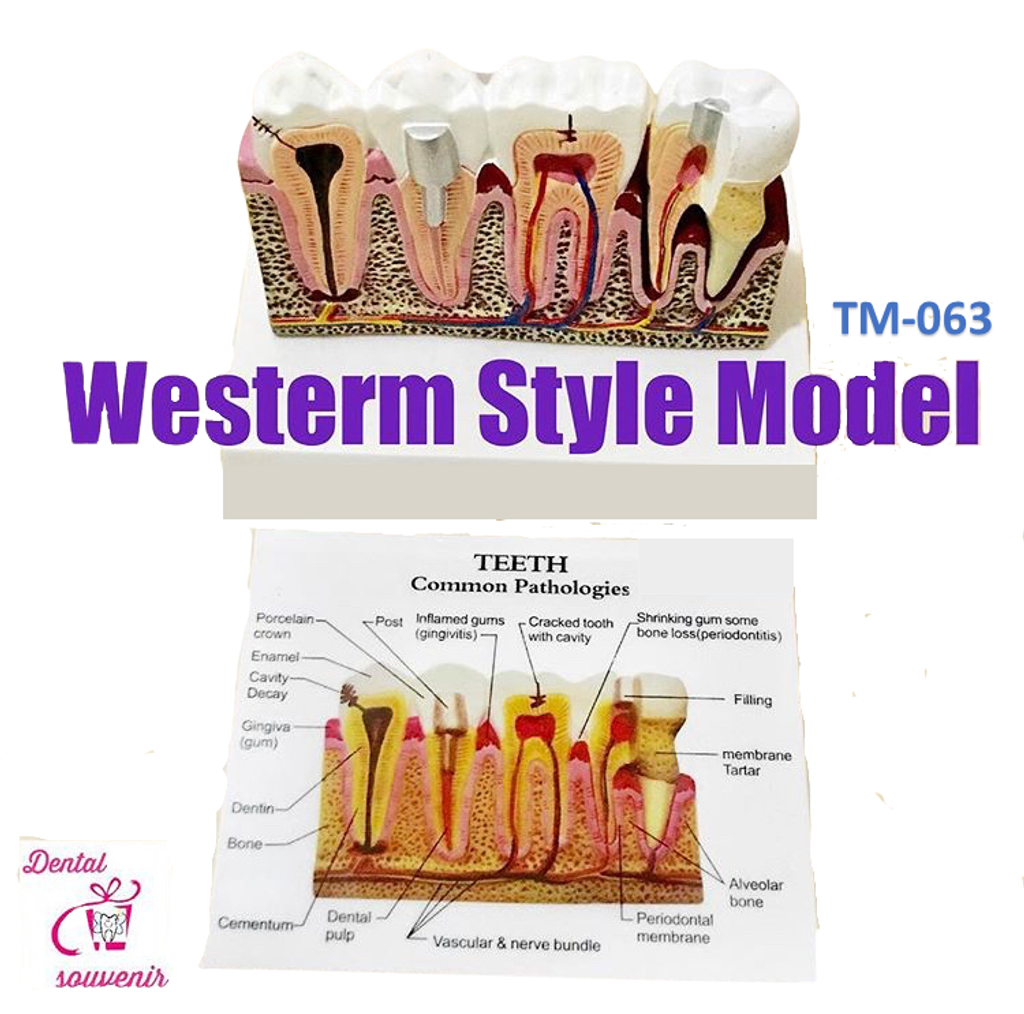 Westerm Style Model.png