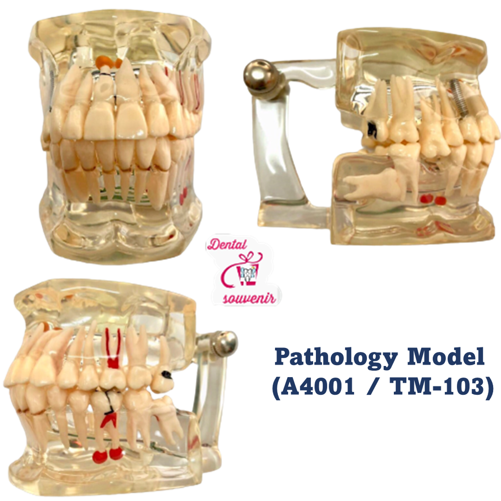 Pathology Model (A4001 _ TM-103).png