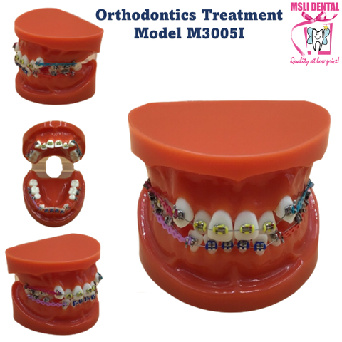 Orthodontics Treatment Model M3005I.png